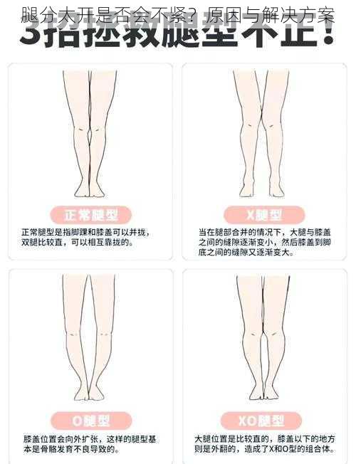 腿分太开是否会不紧?原因与解决方案